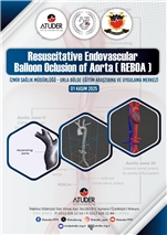 Resuscitative Endovascular Ballon Oclusion of Aorta (REBOA)